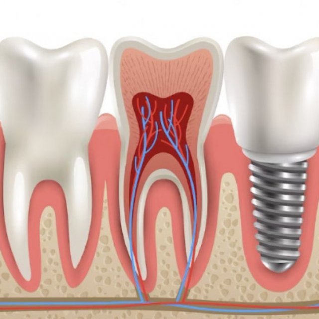 Eco Care Dental Clinic in Nizampet, Hyderabad