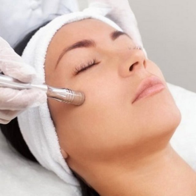 Is Microdermabrasion Good for Sensitive Skin?