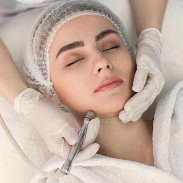 Microdermabrasion Results: What You Can Expect After One Session