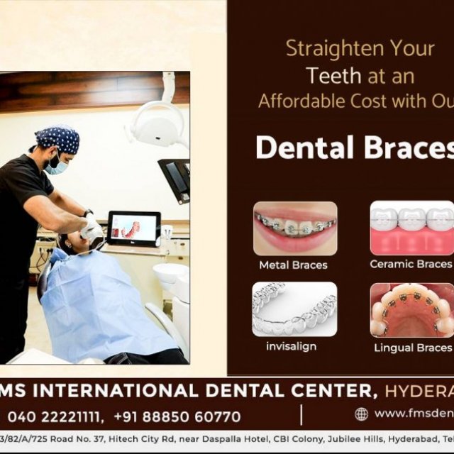 Affordable Braces Cost in Hyderabad, India - FMS Dental