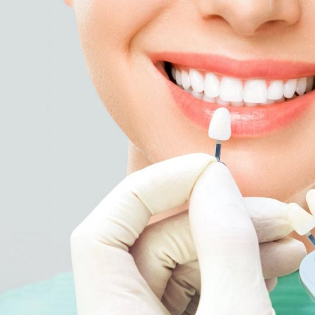 Veneer Treatment Chandigarh