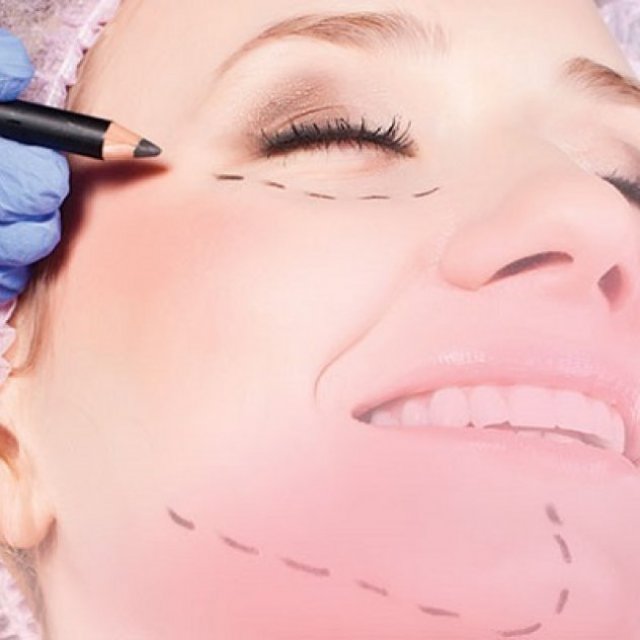 How to Vet Your Eyelid Surgery Specialist: A Comprehensive Guide for Muscat Residents