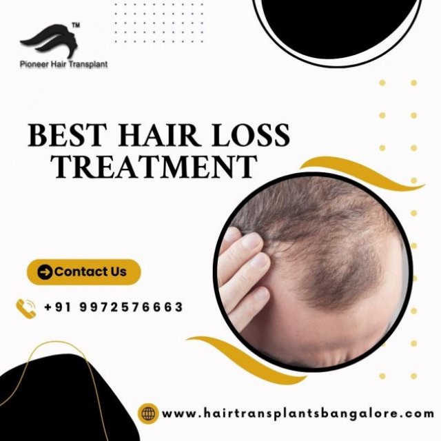 Hair Transplant
