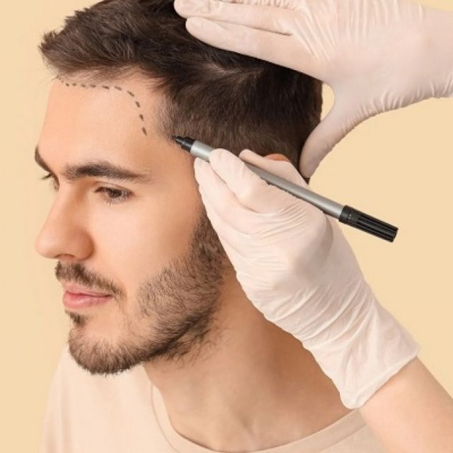 Royal cosmetic surgery