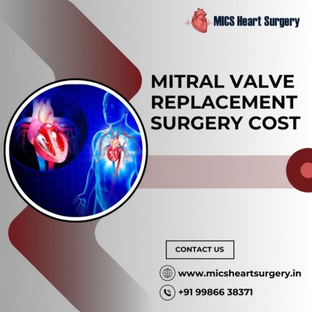 Mics Heart Surgery