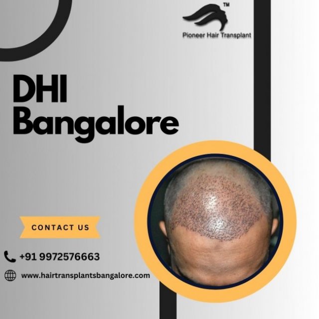 Hair Transplant