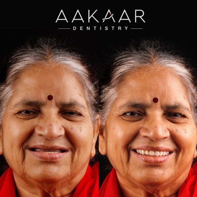 Aakaar Dentistry | Dental Clinic in Bandra