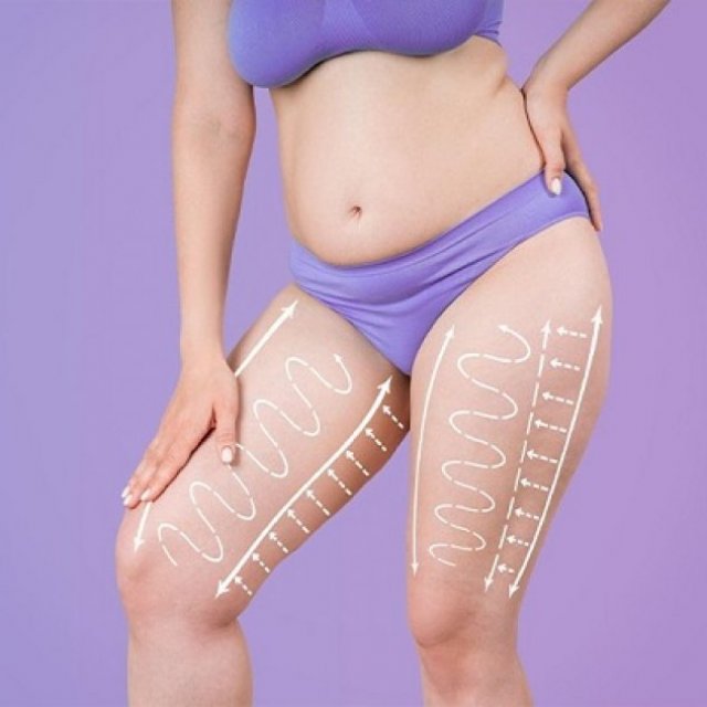 How a Thigh Lift Enhances Your Silhouette