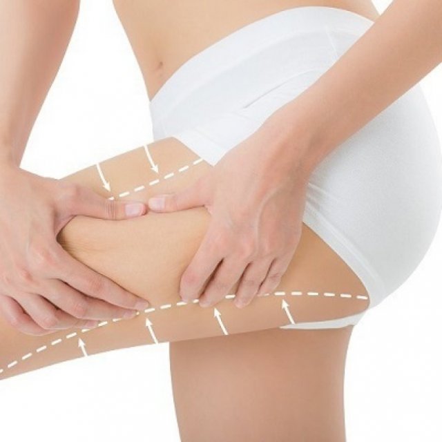 Maintaining Thigh Lift Results Long-Term