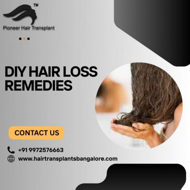 Hair Transplant