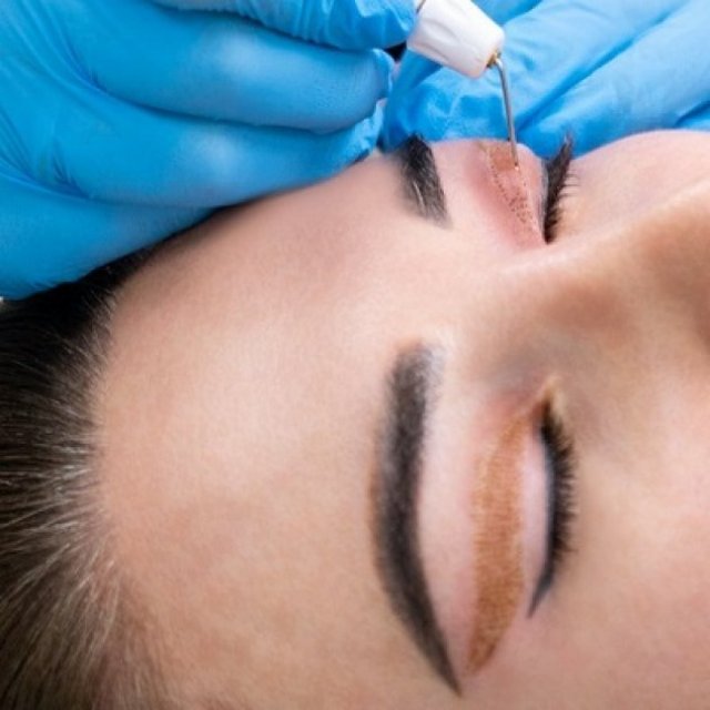 What’s the Science Behind Plexr Plasma Eye Lift?