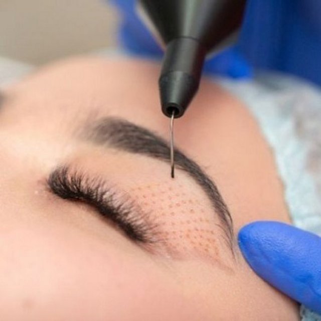Will Plexr Work If I Have Thin Skin Around My Eyes?