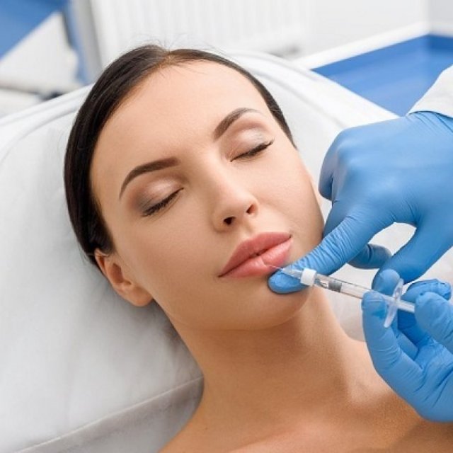 Lip Implants vs. Lip Injections: Pros and Cons