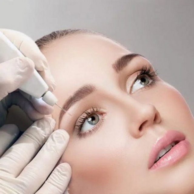 Plexr vs. Blepharoplasty: Which Is Better?