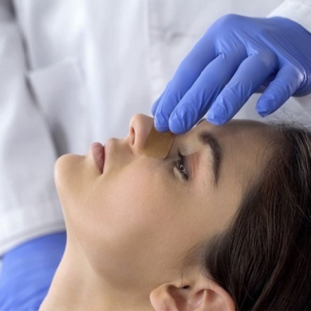Can Septoplasty Help with Chronic Sinusitis?