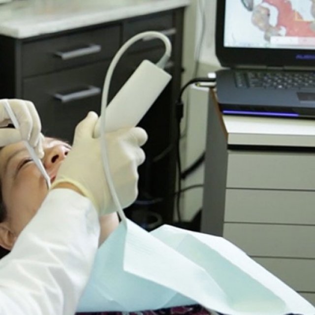 What Is the Trios IntraOral Scanner ?