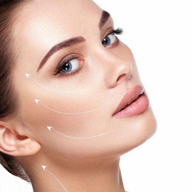 Is the Vector Facelift Better Than Thread Lifting?