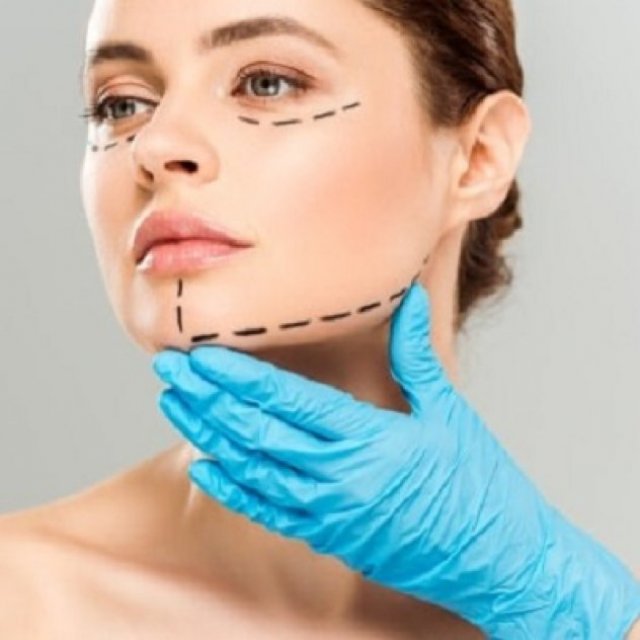 Is the Vector Facelift Safe?