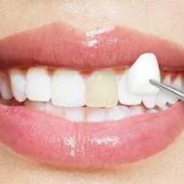 Mesa Dental