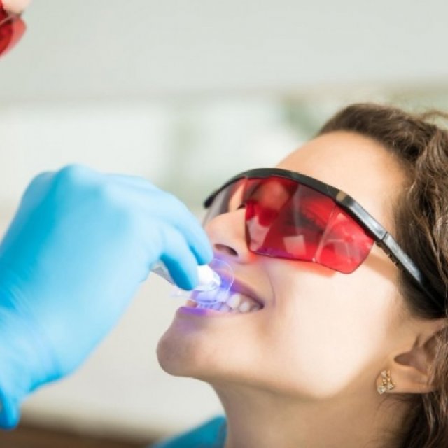 Teeth Whitening In Gurgaon