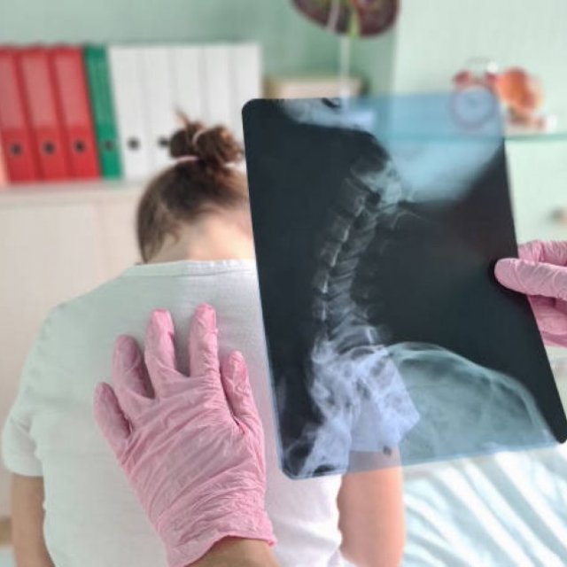 Dr. Arvind G. Kulkarni Best Scoliosis Surgeon in India