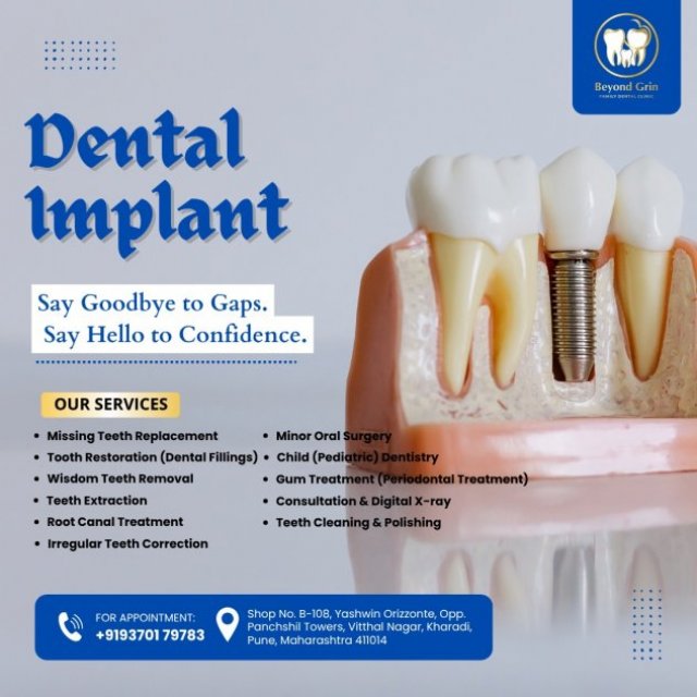 Beyond Grin Family Dental Clinic in Kharadi, Pune is your trusted destination for complete dental care.