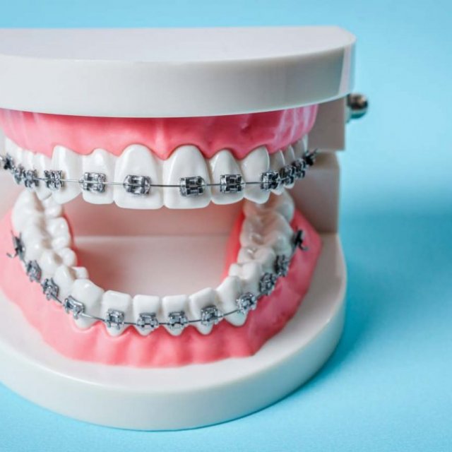 Willowbrook Orthodontics