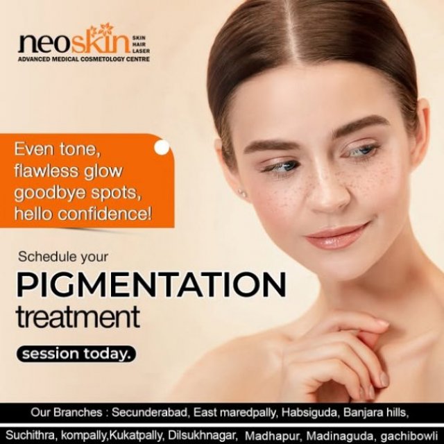 skin pigmentation treatment in Hyderabad | Neoskin